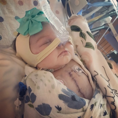 Photo of Sawyer post-surgery