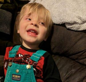 gastroschisis survivor - toddler boy in overalls smiles