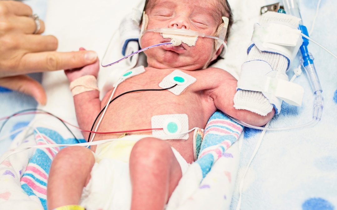 Premature infant lies in NICU, holding finger of caregiver