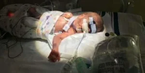 Baby lies in NICU connected to life saving equipment