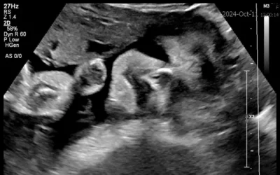 Why fetal MRI & ultrasound images can look supernatural, but their value is out of this world