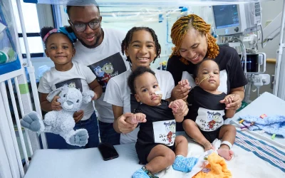 Amari & Javar: conjoined twins separated at CHOP while whole family is given special care