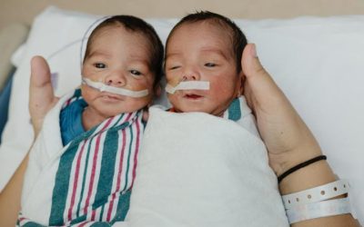 Renny & Benny’s Story: Fetoscopic laser surgery to correct twin-twin transfusion syndrome